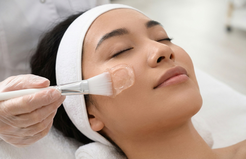 ピーリング施術（約10～20分）顔 画像