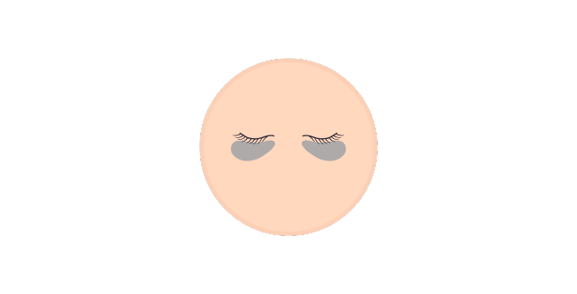 くすみ・色素沈着の改善 画像