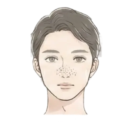 毛穴の黒ずみ・つまり 悩んでいる女性 画像