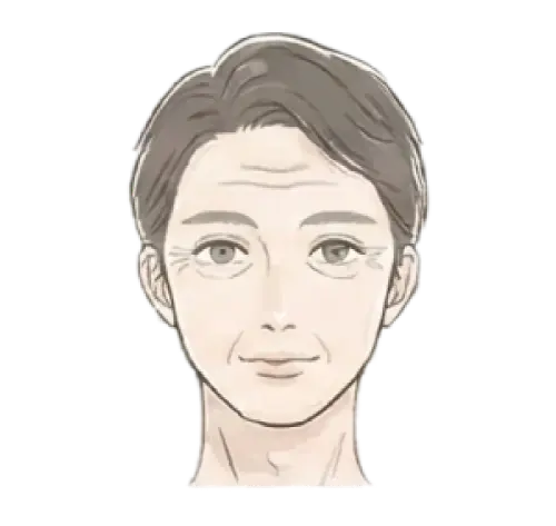 小じわ・ちりめんじわ 悩んでいる女性 画像