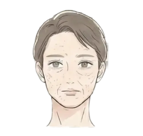 乾燥肌・インナードライ 悩んでいる女性 画像