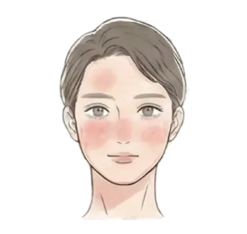 赤み・肌荒れ・敏感肌 悩んでいる女性 画像